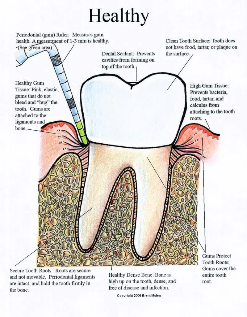 tooth diagram